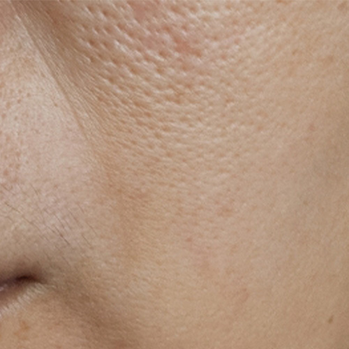 Pale Skin