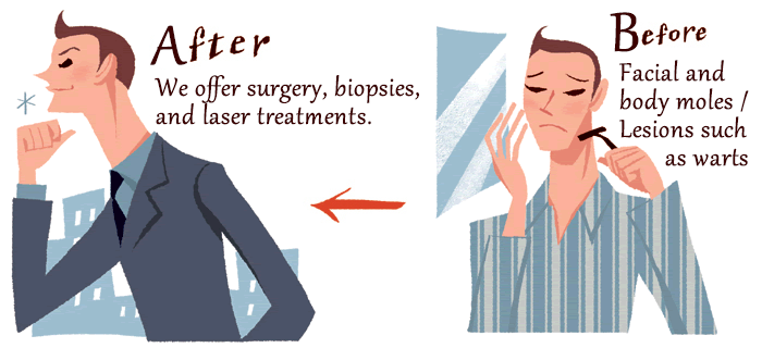 [Before] Facial and body moles / Lesions such as warts [After] We offer surgery, biopsies, and laser treatments.